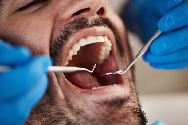 Best Emergency Dental Care for Broken or Chipped Teeth in Nashville, NC